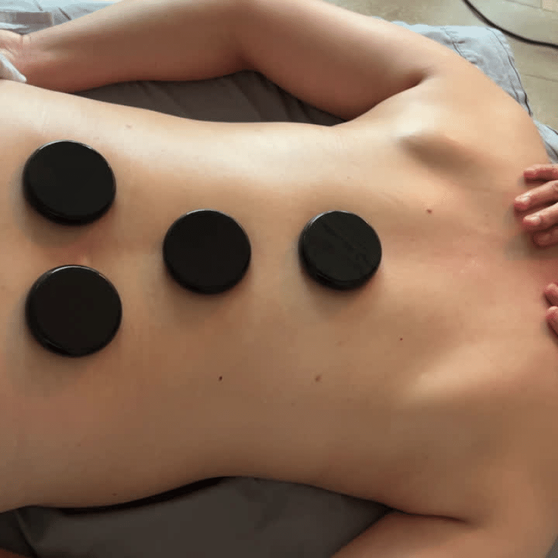 A close-up image depicting a patient's back during a hot stone massage session, where five uniformly-sized round black stones are meticulously placed along the spinal column. The stones' smooth surfaces and dark color provide a striking visual contrast against the client's lighter skin tone. These basalt stones, renowned for their heat retention properties, are placed to target key energy points along the spine, aiming to alleviate deep-seated tension and promote relaxation. The curvature of the client’s back is accentuated by the precise placement of the stones, creating a harmonious symmetry. This treatment setting is typical for a hot stone massage, where the warm stones are an integral part of the therapy designed to enhance the patient's well-being and comfort.