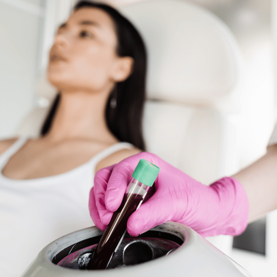 This image shows a woman sitting in a white chair in the background, looking to the side with her eyes open. She's wearing a white tank top, and you can see she has long dark hair. In the foreground, a hand with pink gloves is placing a test tube with a green cap into a machine. The tube is filled with dark red liquid, possibly blood for PRP therapy. PRP therapy is used to help the body heal by using the healing components of the patient's own blood. The pink gloves stand out against the white background, focusing our attention on the action of putting the test tube into the machine, which is part of the PRP therapy preparation.